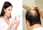 Thảo dược trị rụng tóc
